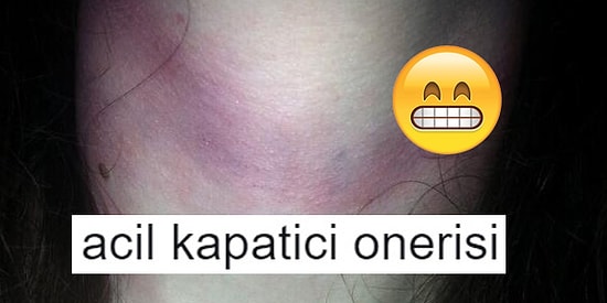 Flörtüyle Girdiği Haşin Mücadeleden Sonra Kapatıcı İstemiş Kıza Öneriler Sunan 15 Goygoycu