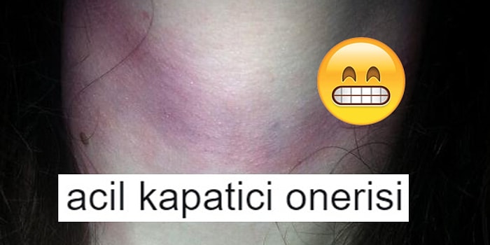 Flörtüyle Girdiği Haşin Mücadeleden Sonra Kapatıcı İstemiş Kıza Öneriler Sunan 15 Goygoycu