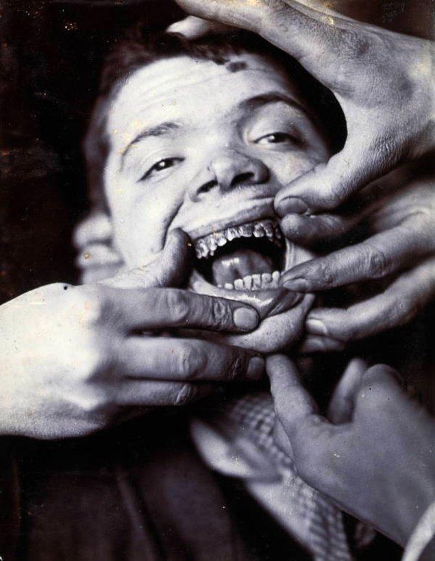 11. Akıl hastanesinde diş tedavisi (!) de gören küçük bir çocuğun, tedaviden sonraki kararmış dişleriyle verdiği poz, yıl 1895.