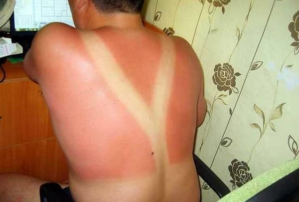 6. Ходить на пляж в подтяжках явно было не лучшей идеей...