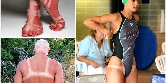 Эти 17 неудачников доказывают, что бывает нечто похлеще, чем "дачный загар"