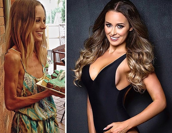 8. Раньше Кейтлин Дэвидсон весила когда-то менее 37 кг, но сейчас она выглядит потрясающе