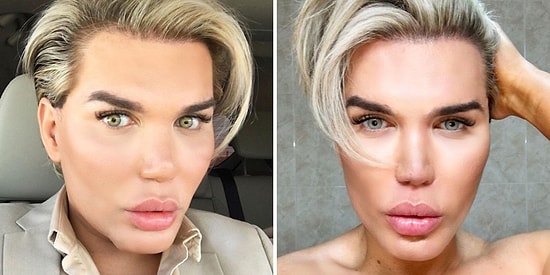 Kör Kalma Riskini Hiçe Sayarak Gözlerinin Rengini Operasyonla Değiştirecek Ken Bebek!