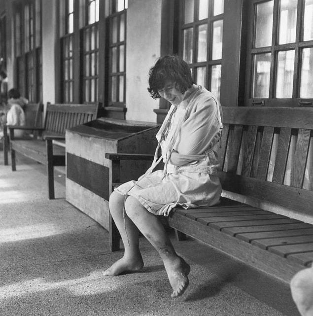 1. A patient sits inside Ohio's Cleveland State Mental Hospital in 1946.