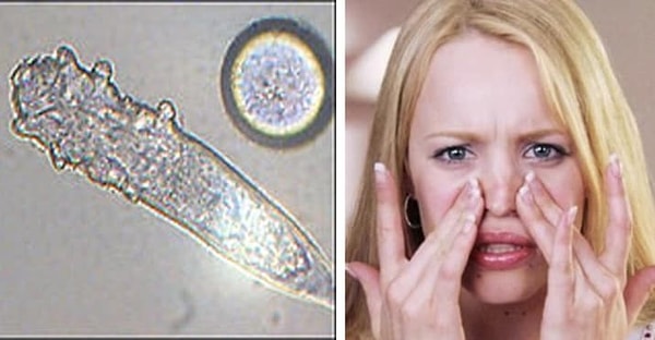 2. На вашем лице живут жучки, которые поедают мертвую кожу