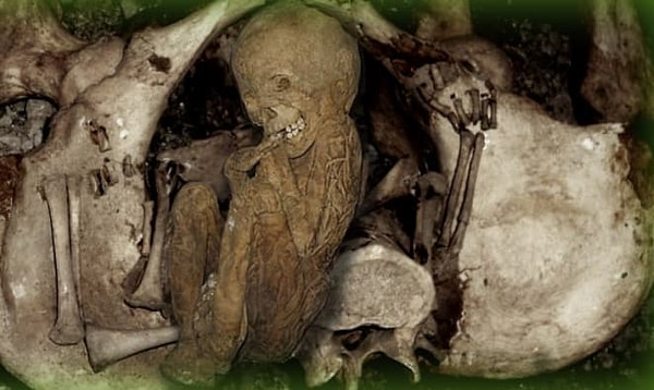 3. В редких случаях умершие женщины могут рожать