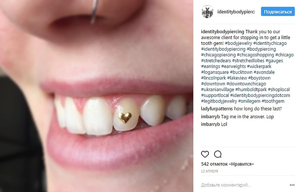 4. Такие стразики выглядят как пирсинг, но никакого прокола зуба, естественно, не делается. Их просто приклеивают на тот же самый клей, что и брекеты