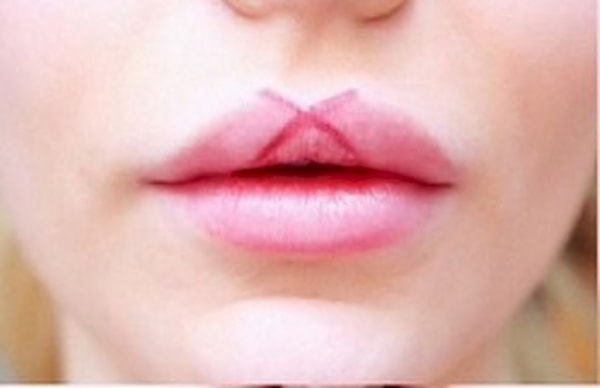 1. Нарисуйте карандашом для губ крестик прямо под дугой Купидона.