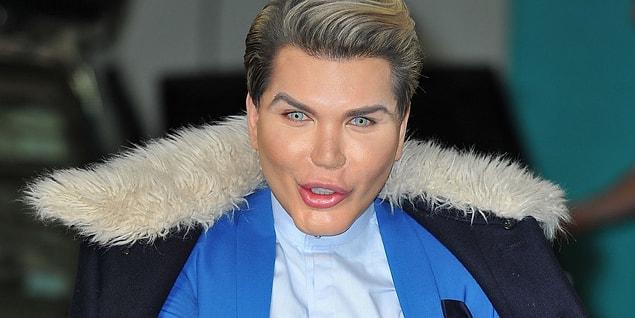 He has already had more than 150 body-changing operations and procedures just to look like the Barbie Ken doll.
