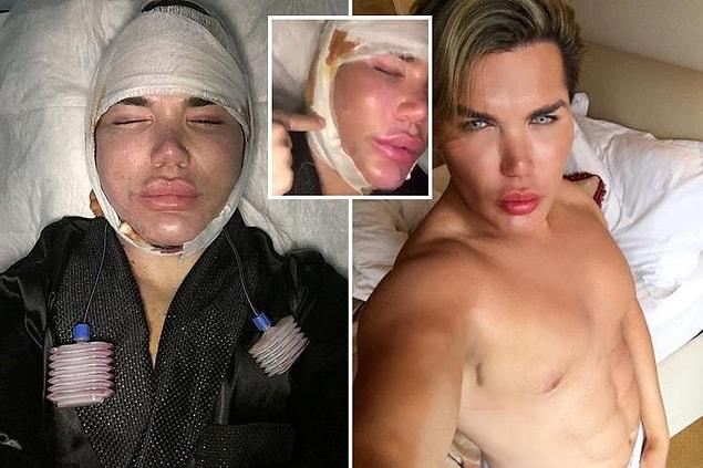 A plastic surgery addict dubbed 'the Human Ken Doll' is in India for a very controversial operation.