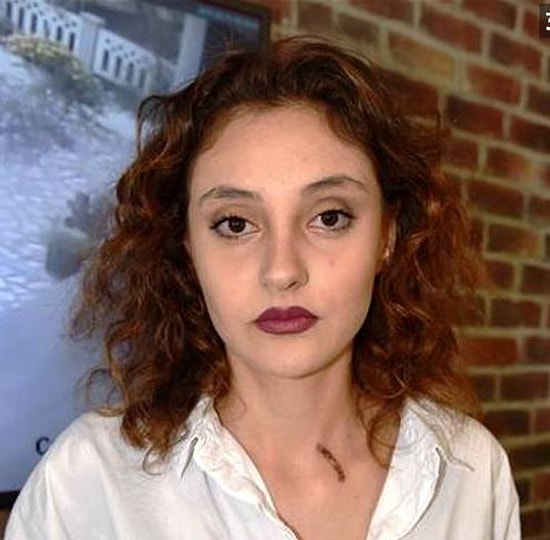 Antalya'da Genç Kadının Boğazında Sigara Söndüren Saldırgan Tutuklandı