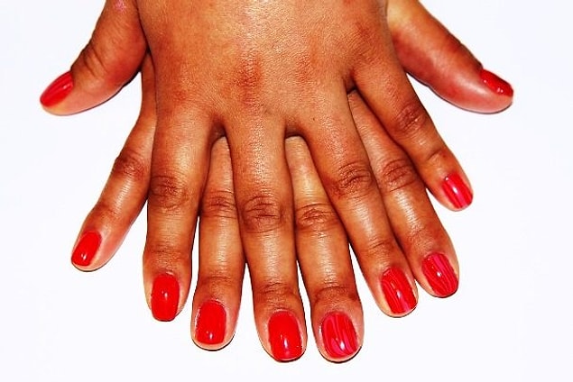 21. Changes in nails could be sign of serious health problems.