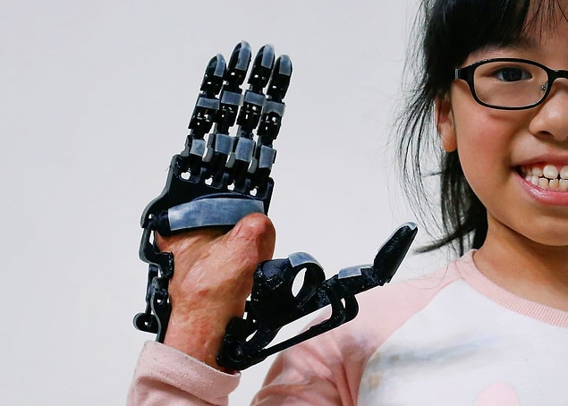 21. 8 yaşındaki Angel Peng 9 aylıkken yanıktan kaybettiği elinin yerine 3 boyutlu yazıcıdan çıkartılmış robotik bir protez deniyor.