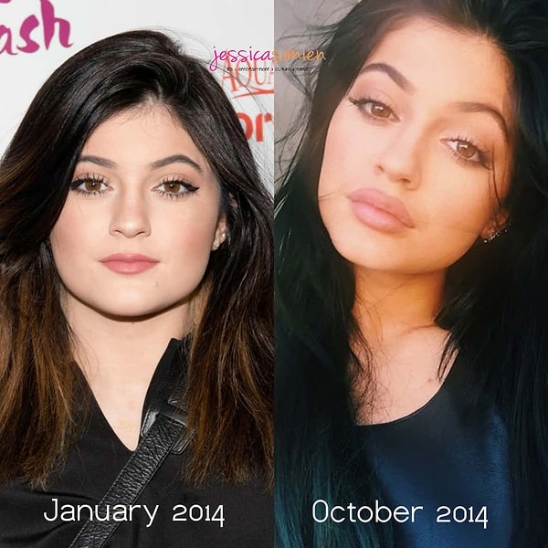 10. Кайли Дженнер