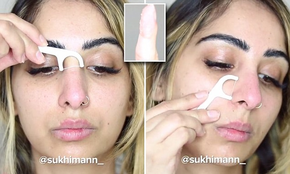 Siyah Noktalarınız İçin Ağız Solüsyonu Kullanmayı Düşündünüz mü?