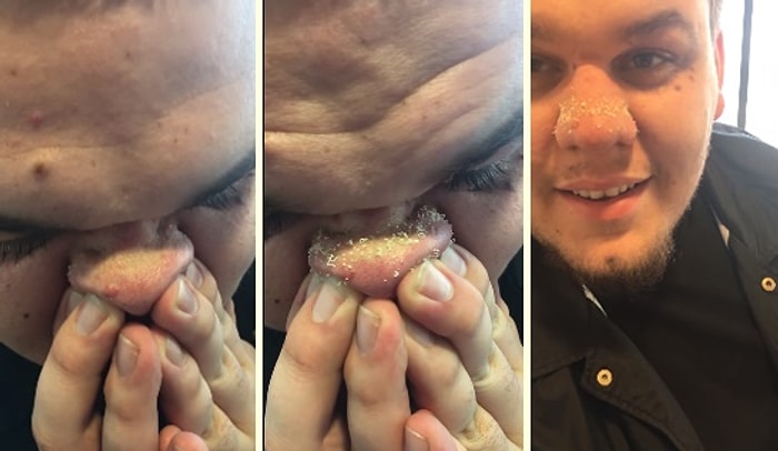 Şimdiye Kadar İzlediğiniz Tüm Siyah Nokta Videolarını Dövecek Seviyede Efsane Video!