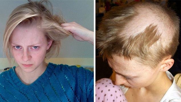 Are these people hurting themselves on purpose by pulling their hair?