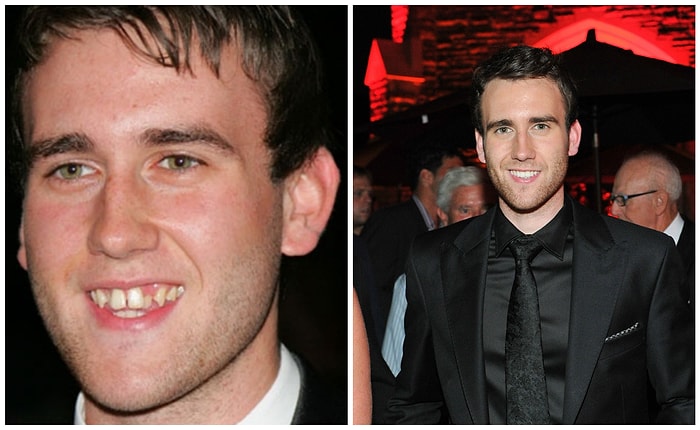 10 звезд, чья карьера сложилась бы совсем по-другому, не сходи они к дантисту