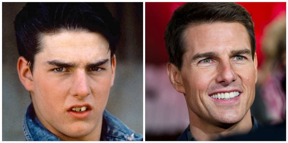 10 звезд, поход которых к дантисту сделал их новыми людьми