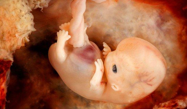 3. Kürtaj için en büyük risk ise rahim içinde parça kalmasıdır.