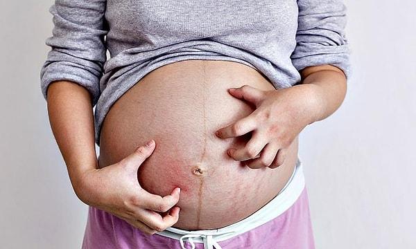 12. Gebelik 10.haftadan büyük ise gebelik anne hayatını tehdit ediyor ise, uzman kişilerden alınan gerekçeli raporlar ile gebelik sonlandırılabiliyor.