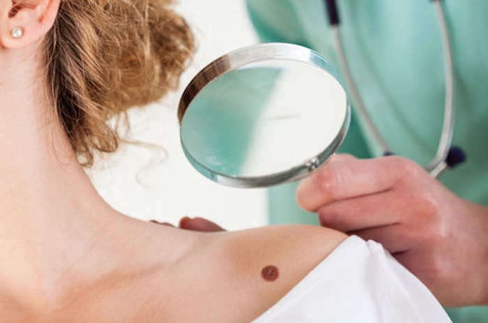 Vücudunuzda Ben Varsa Eğer Onun Hakkında Duymanız Gereken Birkaç Kritik Şey Var!