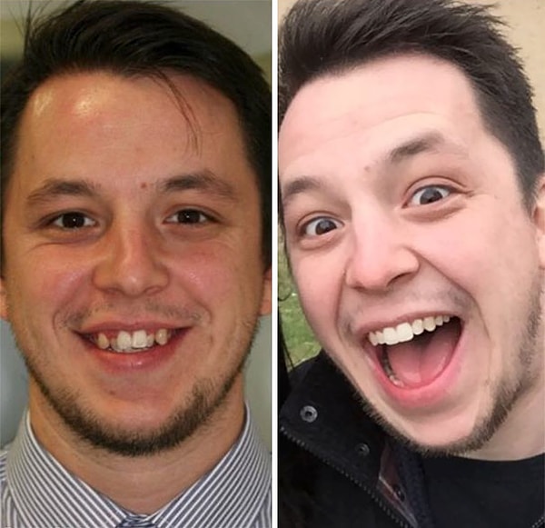 4. "До и После"