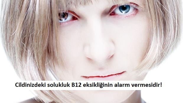 Bu İşaretlere Dikkat Vücudunuzun Vitamin Eksikliği Hakkında Verdiği Önemli Sinyaller 15