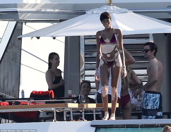 5. Несмотря на особенности кожи, Винни невероятно уверена в себе.