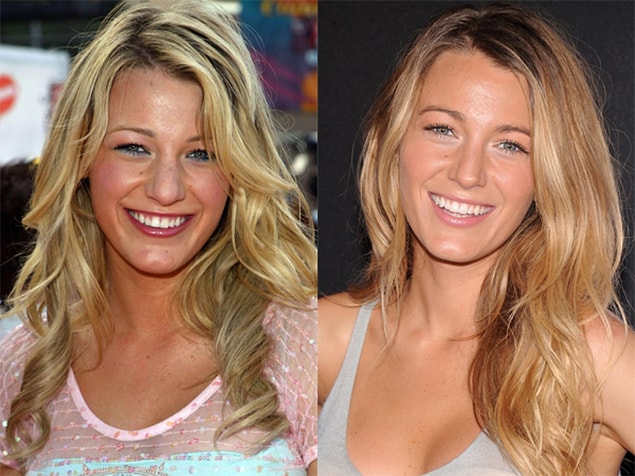 Are the only things preserving her fame her plastic surgeon and hair stylist? We don't know.