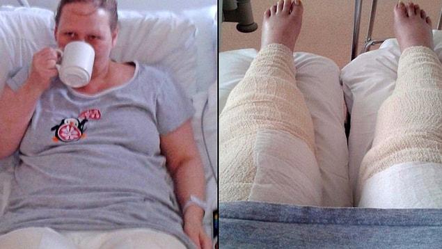 Dana Sedgewick, 44, nearly lost her legs and was in a coma for nine days after she used a new razor on her bikini line and developed a shocking reaction.