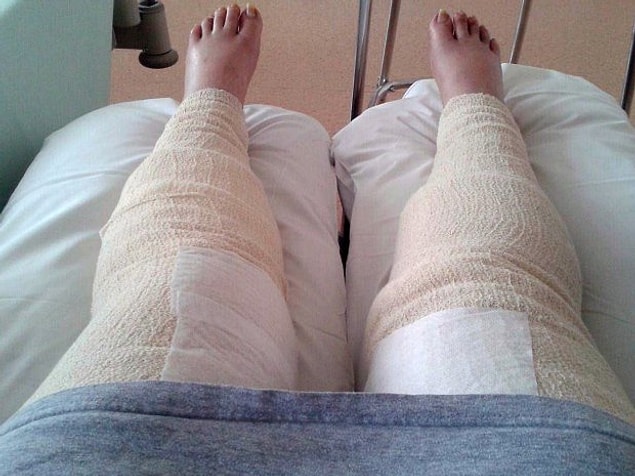 Two days later, she started feeling dizzy and nauseous.