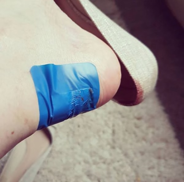 3. Лето - это новый сезон кровавого месива, поэтому запасайтесь лейкопластырями!