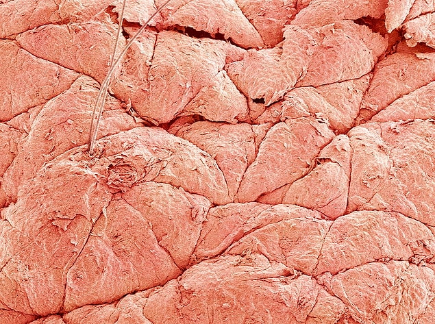 4. Eğer vücudumuzdaki deriyi komple yüzseydik, ağırlığı 2.5 kiloyu geçerdi.