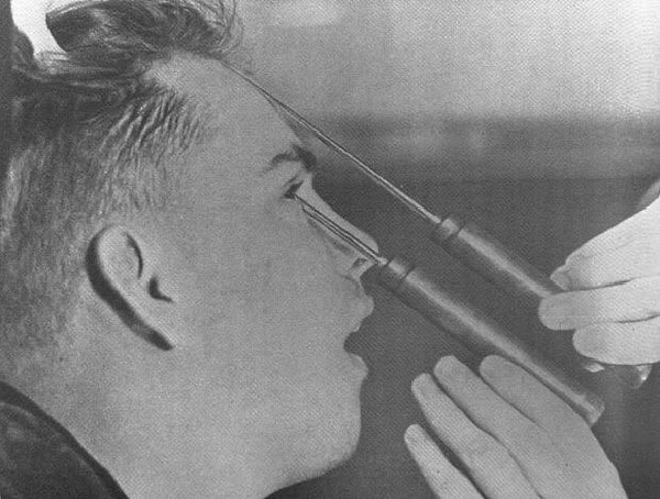 3. Это процедура, заключающаяся в разрезании тканей, соединяющих лобные доли мозга и сам мозг, посредством введения длинных острых игл в глазницы