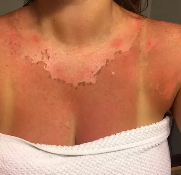 5. Наносить крем в жару ТАААК НАПРЯГАЕТ