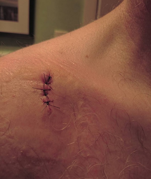 9. Неужели от солнышка могут быть какие-то последствия?