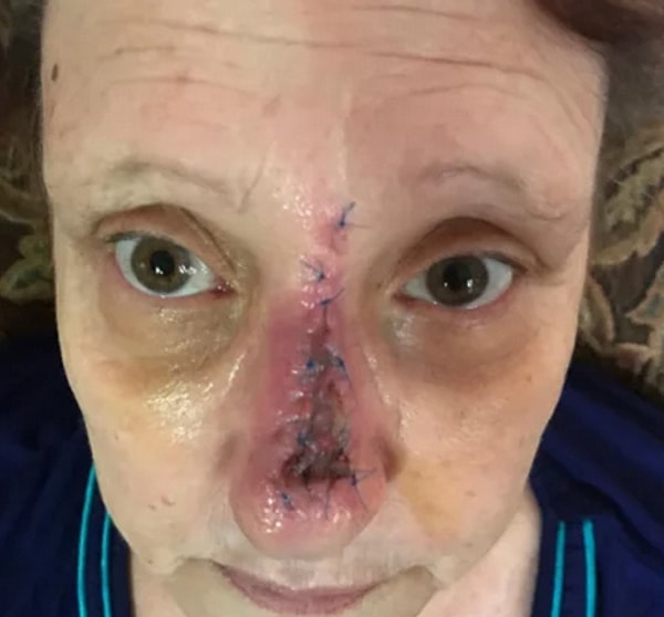 10. Разве рак кожи - это не очередная глупость, придуманая фармацевтами?