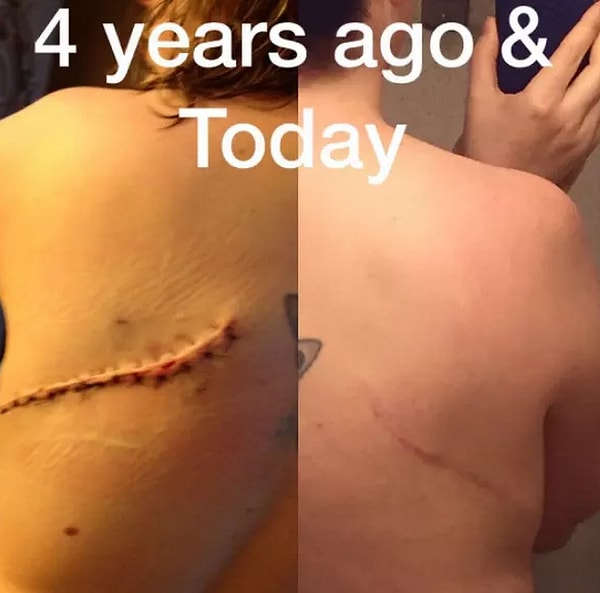 12. Да кого вообще это волнует, когда вы можете получить прекрасную загорелую кожу