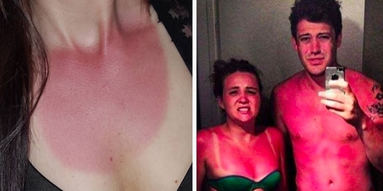 15 убедительных причин никогда не пользоваться солнцезащитным кремом