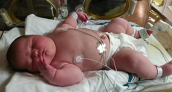 Женщина родила девочку весом более 6 кг