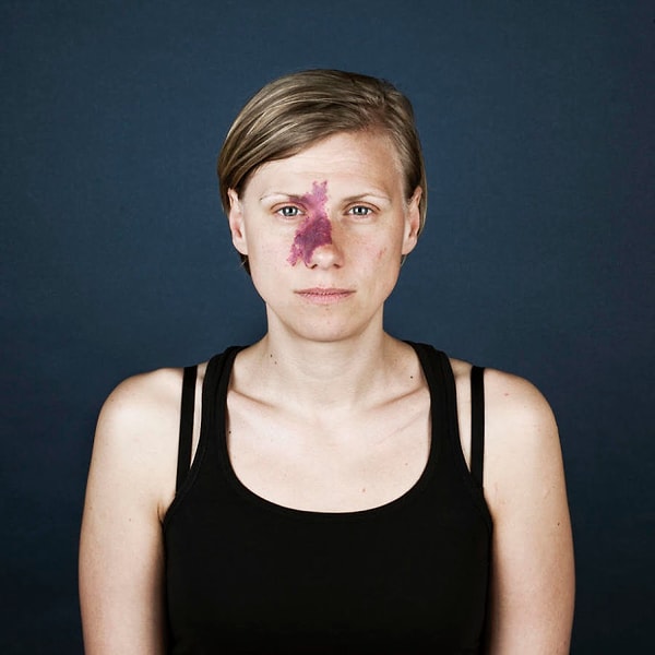 8. ...фотограф Линда Хансен призывает смотреть на её фотопортреты очень пристально, дабы рассмотреть за природной отметиной именно ЛИЧНОСТЬ человека.