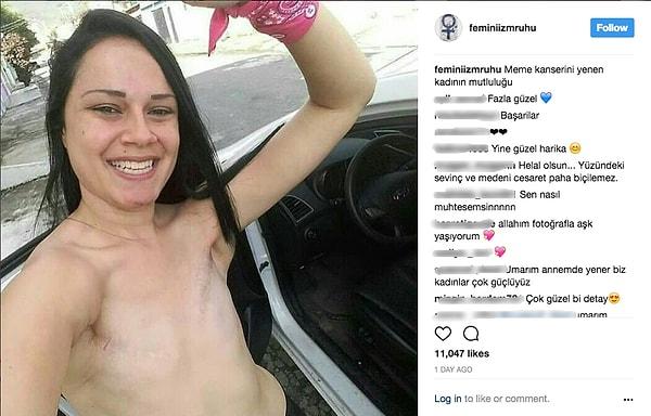 Bu genç kadın yendiği meme kanserinin ardından mutluluğunu paylaşmak adına gülen yüzüyle harika bir fotoğraf çekilmiş ve bir Instagram hesabı da bu fotoğrafı paylamış.