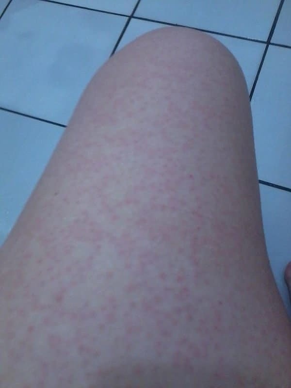 5. А когда на улице чуть похолодает, вы легко превращаетесь в гуся! 😂