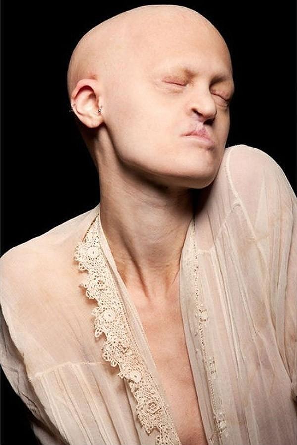 7. Именно на этом сайте её заметил испанский фотограф Эухенио Рекуэнко, который предложил девушке сняться в клипе группы "Рамштайн" (2012 год). Именно эта работа принесла Мелани мировую известность.