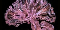 Yaşayan Bir Sanat Eserine Dönüşen İnsan Beyni