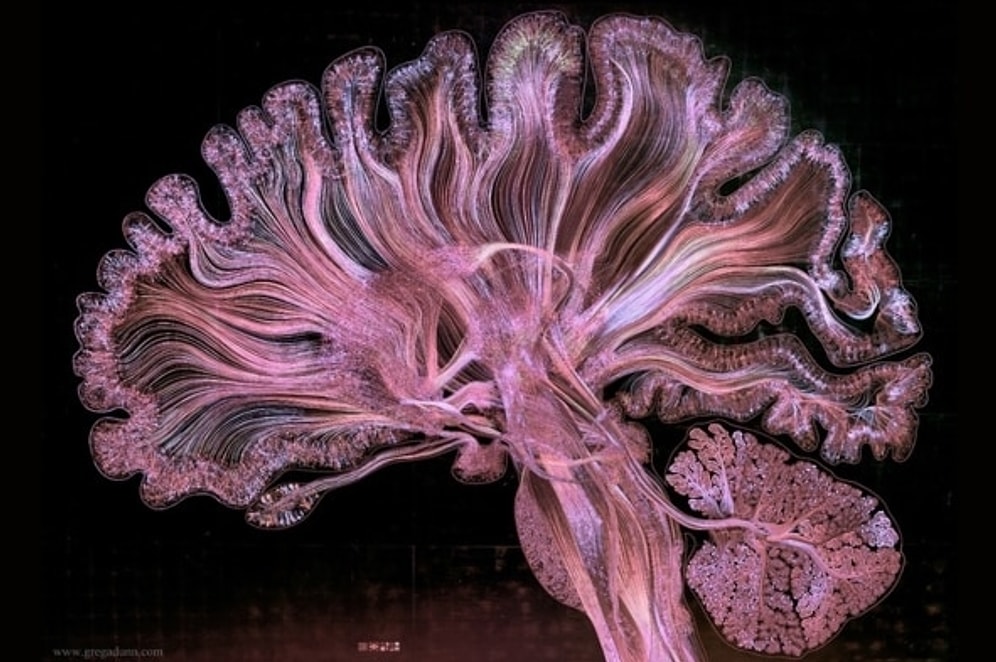 Yaşayan Bir Sanat Eserine Dönüşen İnsan Beyni