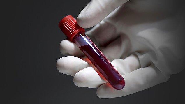 4. UCLA’daki doktorlar, bir hastanın kanındaki eşsiz kan hücrelerini onun izni, hatta haberi dahi olmadan alıp ilaç olarak geliştirdi.