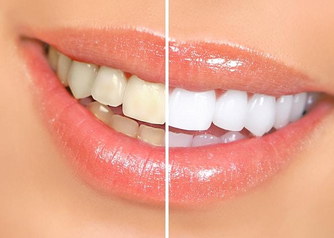 Sadece 10 Saniyenizi Ayırdığınızda Dişlerinizi İnci Gibi Bembeyaz Yapacak Enfes Buluş: Amabrush