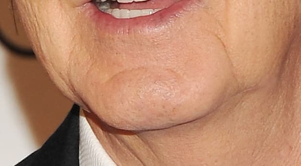 3. Подбородок уже немолодого человека может принадлежать...?